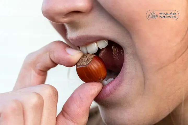 مضرات آجیل برای دندان